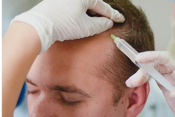 Регенерация волос Regenera: как все происходит и какой эффект от процедуры?