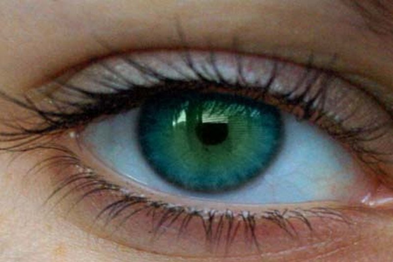 Почему у человека может измениться цвет глаз