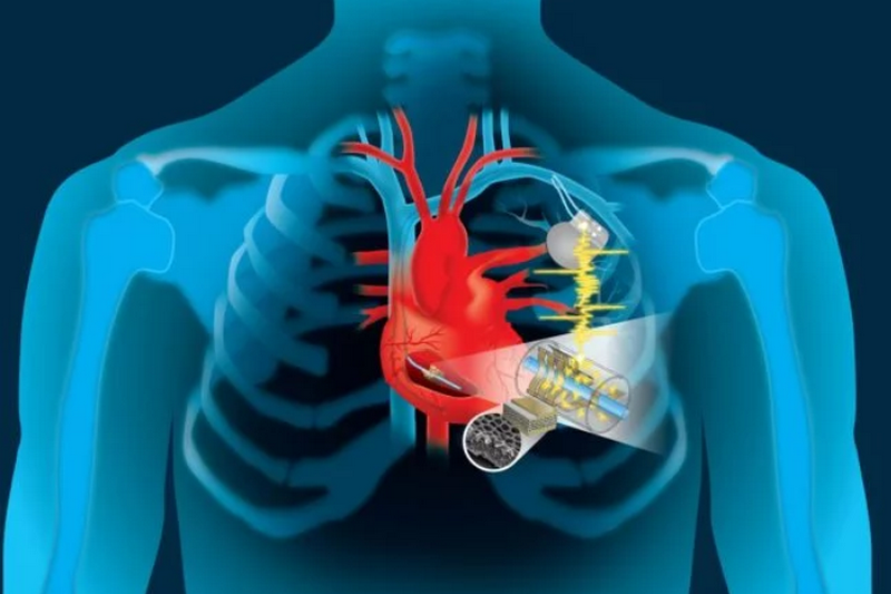 Вечный «мотор»: энергию сердца можно использовать для подзарядки кардиостимуляторов