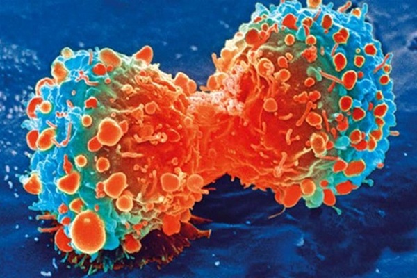 Совершен прорыв в лечении смертельных форм рака