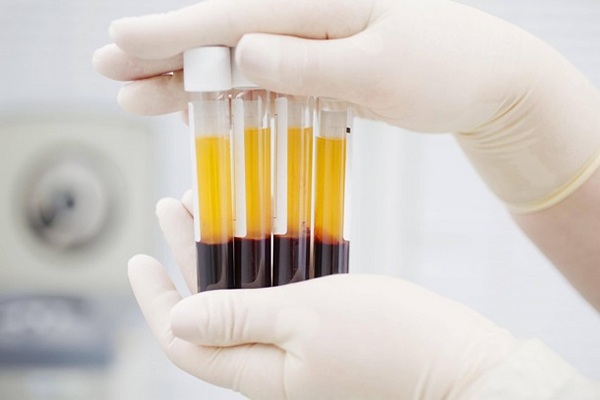 Вся донорская кровь загрязнена следами кофе и лекарств - ученые