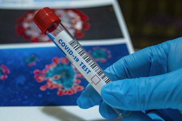 В Украине уменьшается количество случаев коронавируса