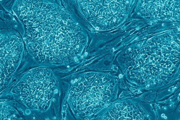 Ученым удалось вырастить маленькие сердца из стволовых клеток