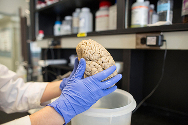 Ученые разгадали столетнюю тайну мозга