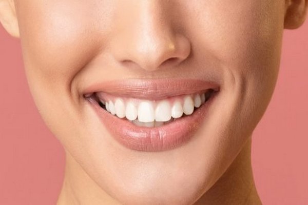 Стоматологи рассказали все о плюсах и минусах отбеливания зубов