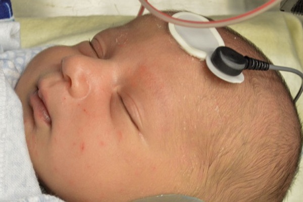 Ученые предложили новый метод для диагностики аутизма у новорожденных