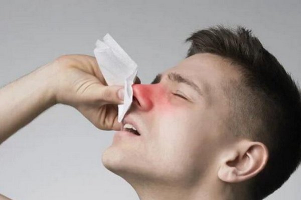 Причины, способные провоцировать кровотечение из носа
