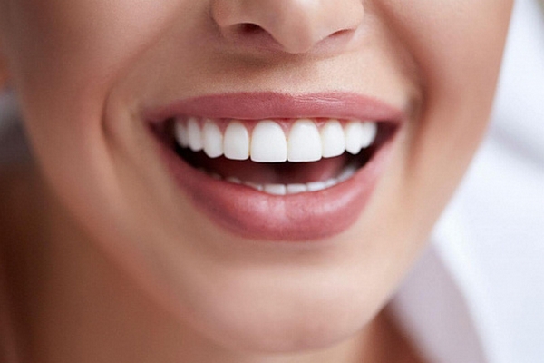 Вініри - одна з кращих розробок естетичної стоматології