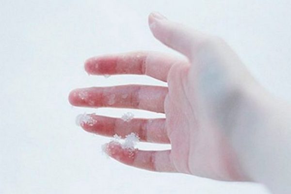Врач: переохлаждение рук чревато серьезными воспалениями