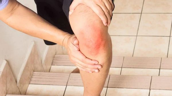 Бурсит коленного сустава: причины, симптомы и лечение