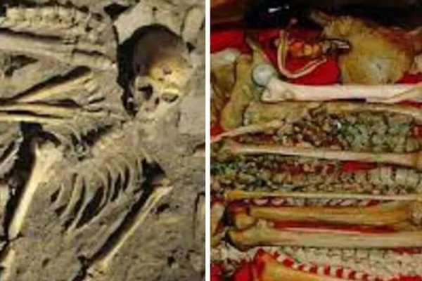 Ученые обнаружили, какие болезни убивали тысячи людей эпохи неолита: они дошли и до наших времен