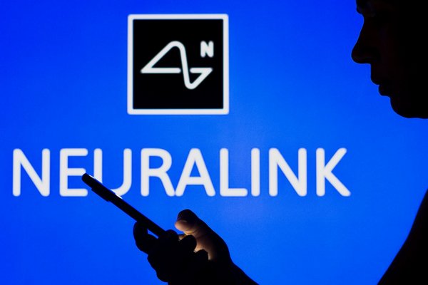 Технология, которая вернет голос: как Neuralink меняет жизни